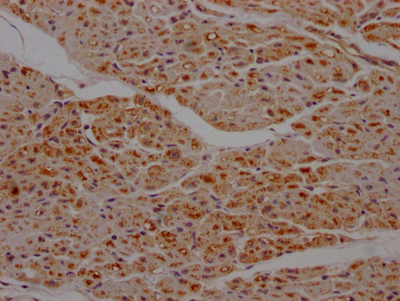 SDHB Antibody