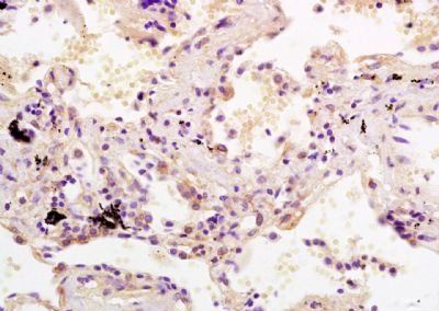 SDHC Rabbit Polyclonal Antibody