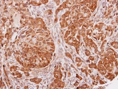 SEC13L1 Rabbit Polyclonal Antibody