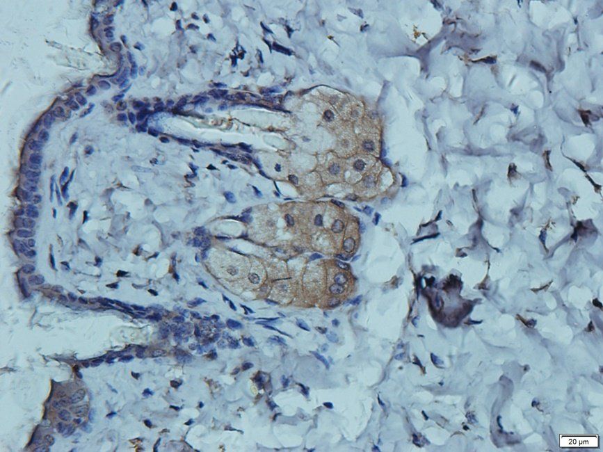 SEMA3A Rabbit Polyclonal Antibody