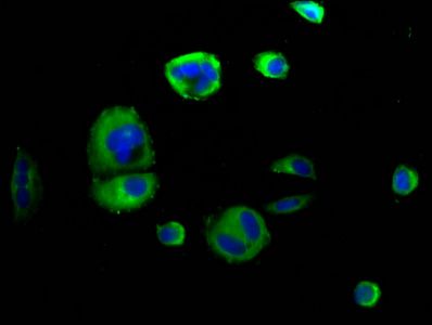 SEMA4D Antibody
