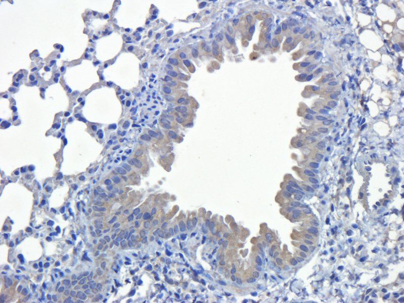 SEMA3A Rabbit Polyclonal Antibody