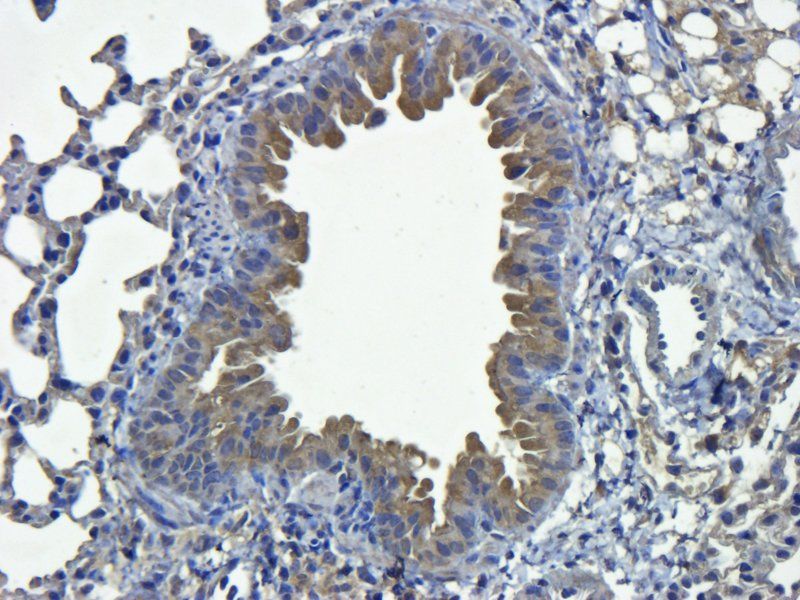 SEMA3A Rabbit Polyclonal Antibody