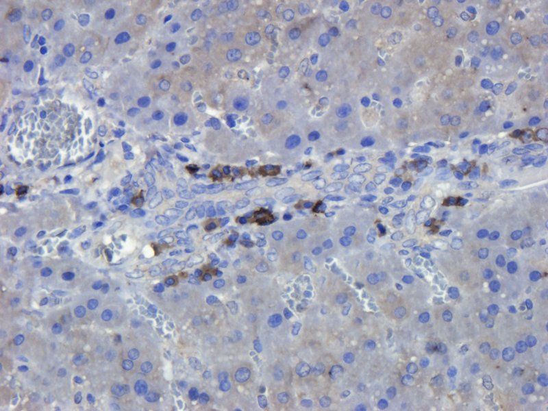 SEMA3A Rabbit Polyclonal Antibody