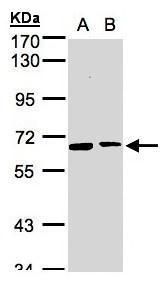 SENP2 Rabbit Polyclonal Antibody