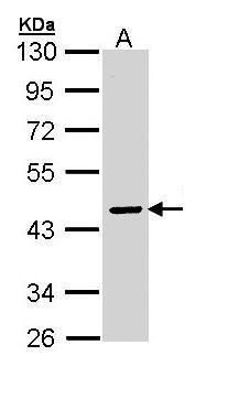 ATP6V0A2 Rabbit Polyclonal Antibody