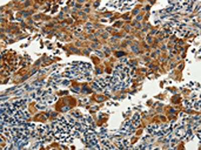 SERPINA9 Antibody