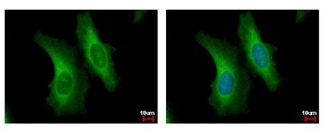 SERPINB6 Rabbit Polyclonal Antibody
