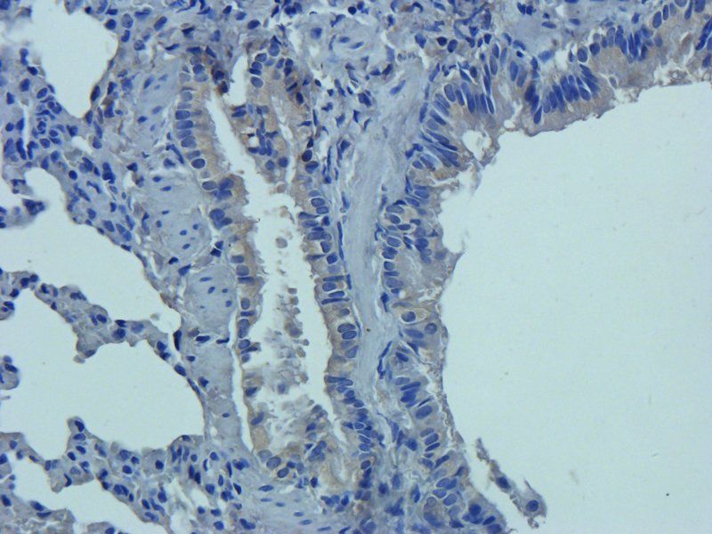 SERPING1 Rabbit Polyclonal Antibody