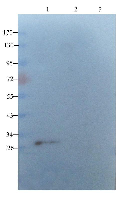 SERPING1 Rabbit Polyclonal Antibody