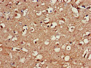 SERPINI1 Antibody
