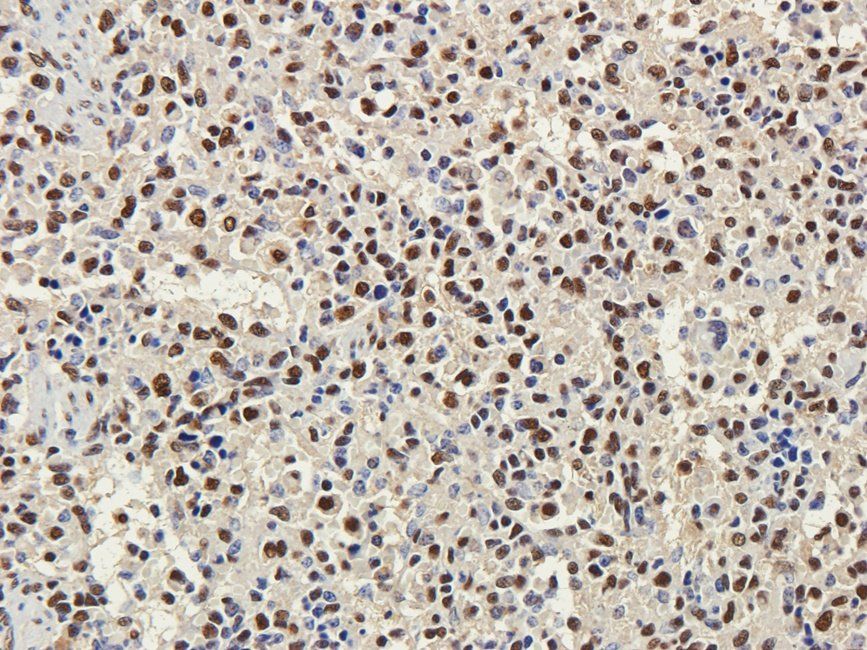 SET Rabbit Polyclonal Antibody