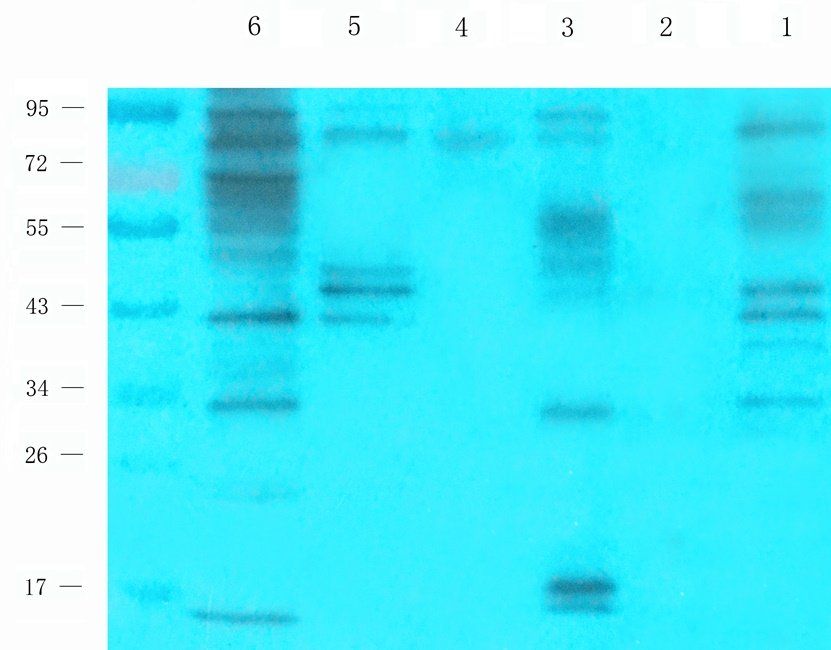 SET Rabbit Polyclonal Antibody