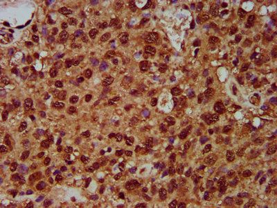 SF3B1 Antibody