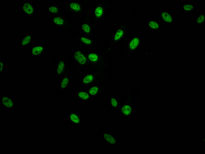 SF3B1 Antibody