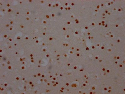 SF3B1 Antibody