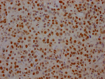 SF3B1 Antibody