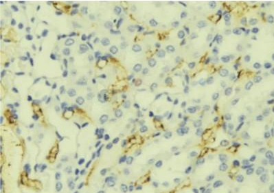 SAA1/2 Antibody
