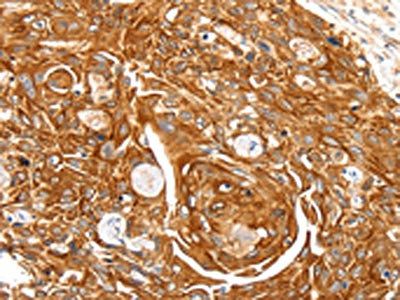 SFTPA1 Antibody