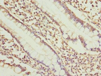 SGCD Antibody