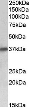 Delta-Sarcoglycan (aa245-257) Antibody