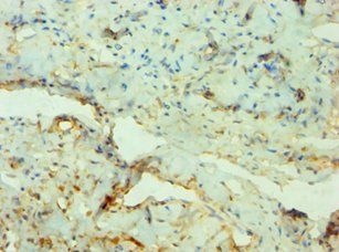 SGK3 Antibody