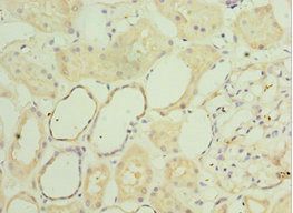 SGSH Antibody
