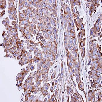 SGSH Rabbit Polyclonal Antibody