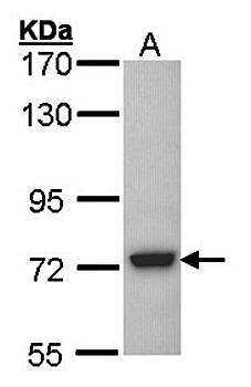 SGSH Rabbit Polyclonal Antibody