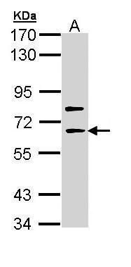 PKC alpha Rabbit Polyclonal Antibody