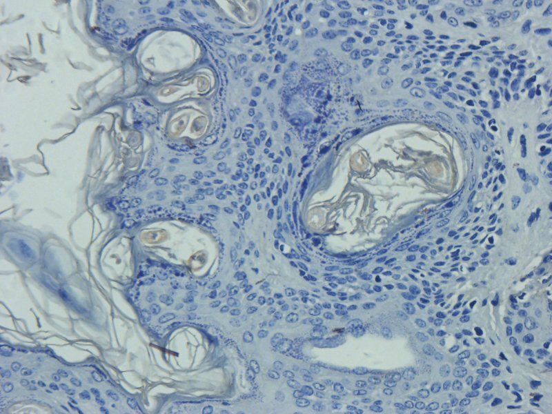 Sialoadhesin Rabbit Polyclonal Antibody