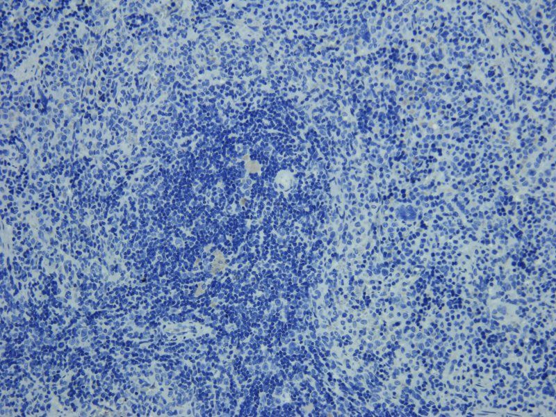 Sialoadhesin Rabbit Polyclonal Antibody