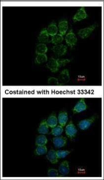 SIAT4A Rabbit Polyclonal Antibody