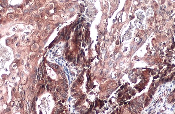 SIAT4A Rabbit Polyclonal Antibody