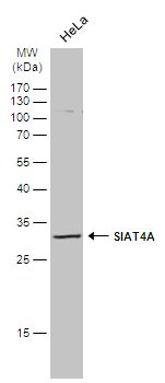 SIAT4A Rabbit Polyclonal Antibody