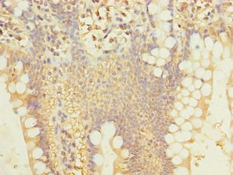 SIPA1L2 Antibody