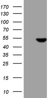 SLAMF7 Antibody