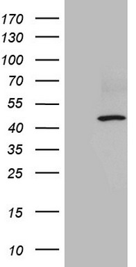 SLAMF7 Antibody