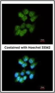 Slap Rabbit Polyclonal Antibody