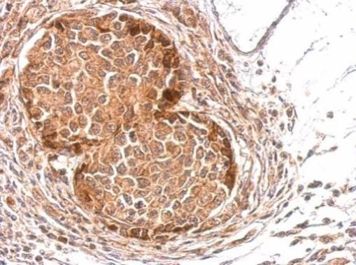 Slap Rabbit Polyclonal Antibody