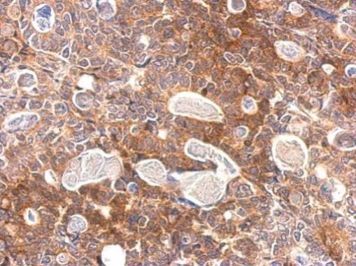 Slap Rabbit Polyclonal Antibody