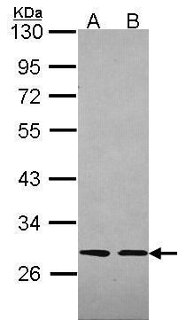 Slap Rabbit Polyclonal Antibody