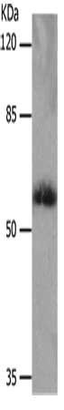 SLC16A4 Antibody