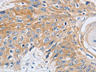SLC16A7 Antibody
