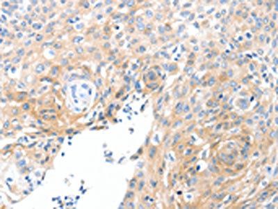 SLC22A17 Antibody