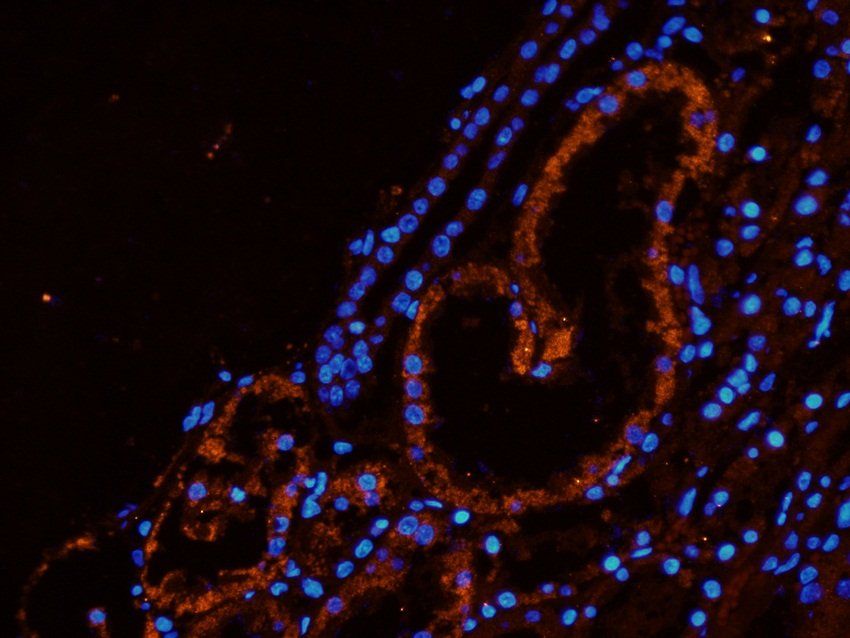 SLC22A6 Rabbit Polyclonal Antibody
