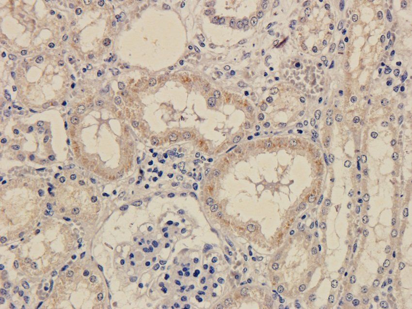 SLC22A6 Rabbit Polyclonal Antibody