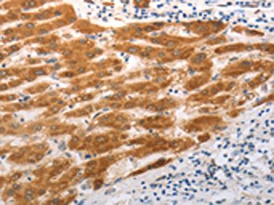 SLC22A8 Antibody