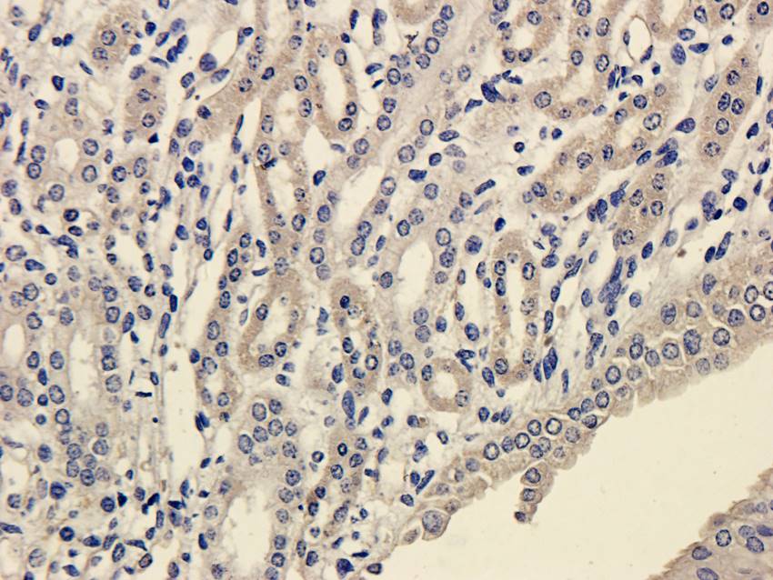 SLC22A8 Rabbit Polyclonal Antibody