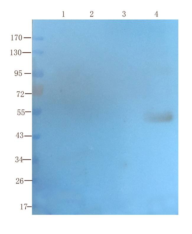 SLC22A8 Rabbit Polyclonal Antibody